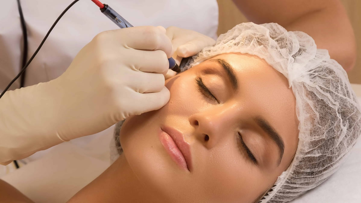 İĞNELİ EPİLASYON